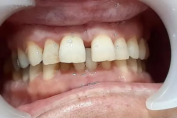 Özel Güneşevler Diş Polikliniği - Resim 7