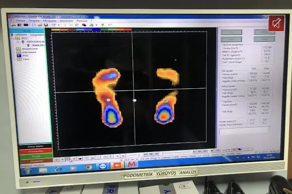 Ekspermed Ortopedi Medikal Sağlık Ürünleri - Resim 9