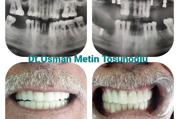 Özel Malatya Akademi Ağız ve Diş Sağlığı Polikliniği - Resim 13