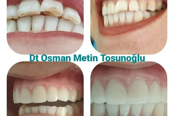 Özel Malatya Akademi Ağız ve Diş Sağlığı Polikliniği - Resim 15