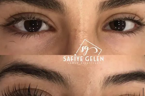 Safiye Gelen Uzman Estetisyen - Resim 3