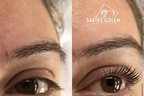 Safiye Gelen Uzman Estetisyen - Resim 12