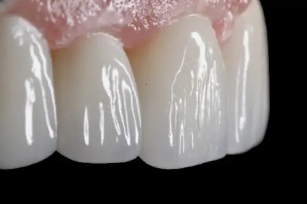 DigitalDent Ağız ve Diş Sağlığı Polikliniği - Resim 14