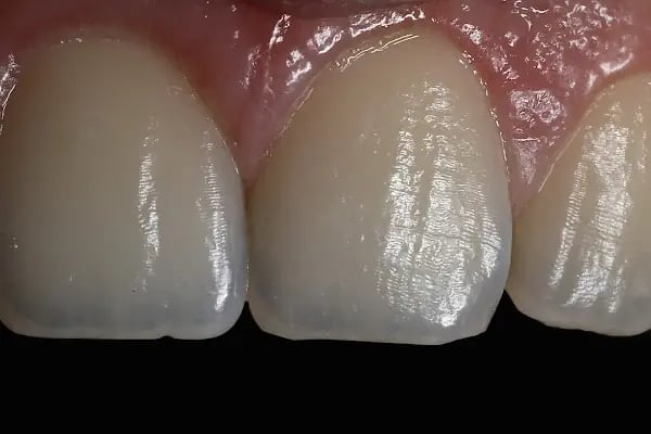 DigitalDent Ağız ve Diş Sağlığı Polikliniği - Resim 13