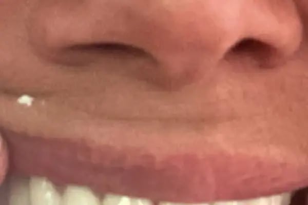Dental Clinic Turkey - Resim 18