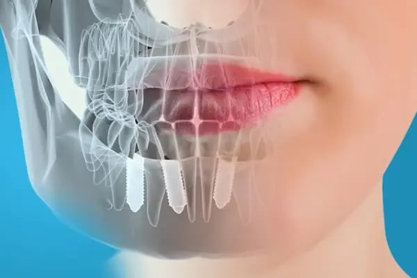 Queen Dental Center - Resim 9