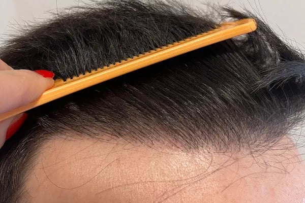 hair of diyarbakır - Resim 14