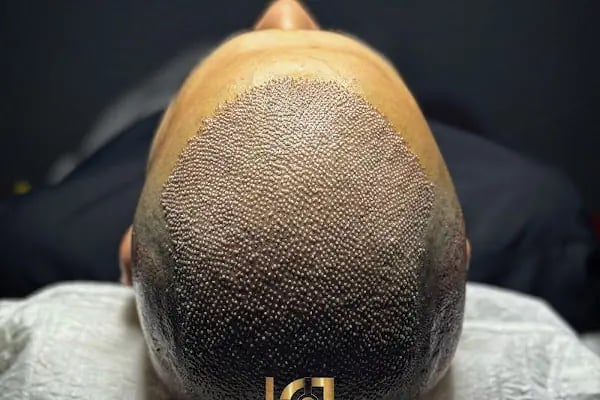 hair of diyarbakır - Resim 3