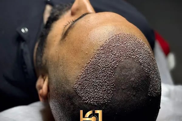 hair of diyarbakır - Resim 9