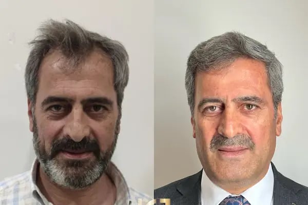 hair of diyarbakır - Resim 15