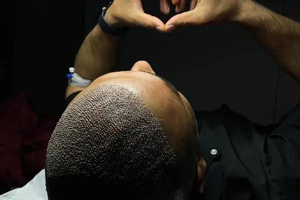 hair of diyarbakır - Resim 13