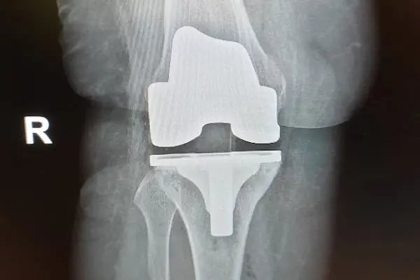 Op. Dr. Yıldıray Genç - Resim 8
