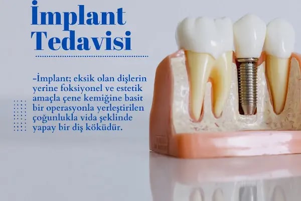 Ay Işığı Ağız ve Diş Sağlığı Polikliniği - Resim 11