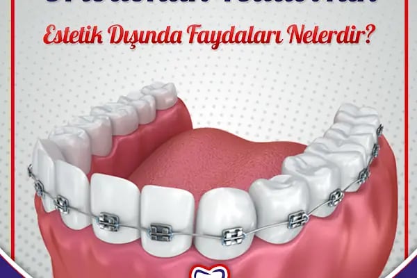 Malatya Uzman Ağız ve Diş Sağlığı Polikliniği - Resim 14