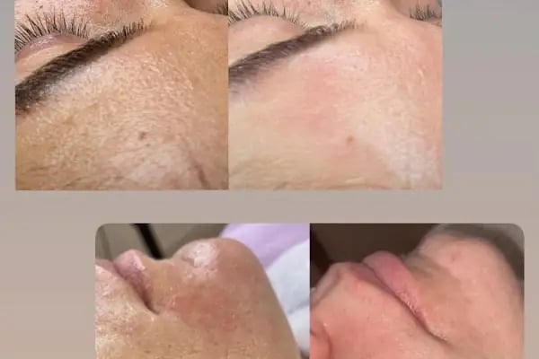 Butterfly Effect BEAUTY CENTER - Resim 15