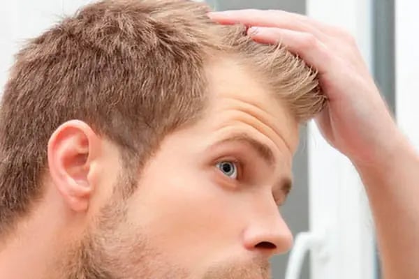 İzmir Saç Ekimi | İzmir Hair Transplantation | Serena Polikliniği | İzmir Kaş Ekimi - Resim 2