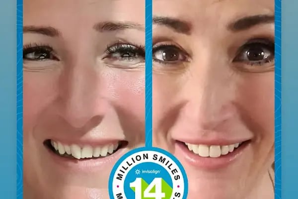Ortodonti Uzmanı Dr. Begüm Ulaşan - Resim 9