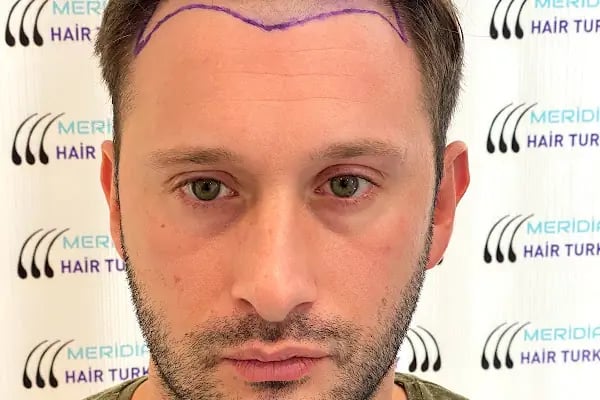 Meridian Hair Turkey - Resim 13
