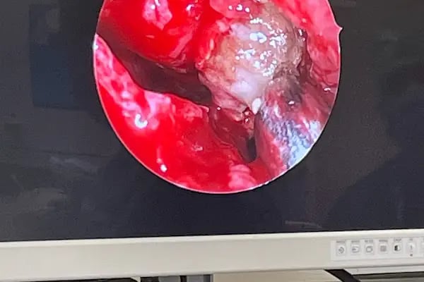 Op. Dr. İrfan Rauf AKSOY - Resim 15