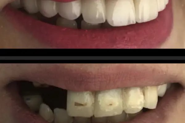 MineDent-Sağlık - Resim 8