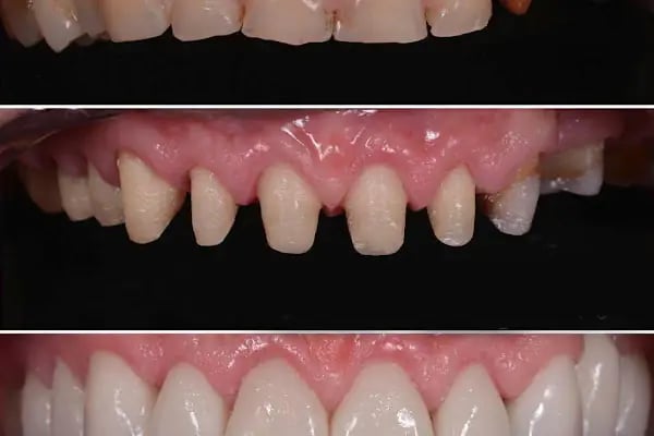 MineDent-Sağlık - Resim 4