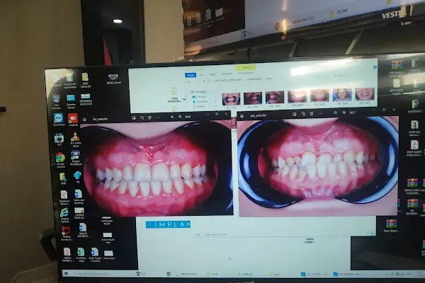 DENT AKGÜL Ağız ve Diş Sağlığı Polikliniği - Resim 14