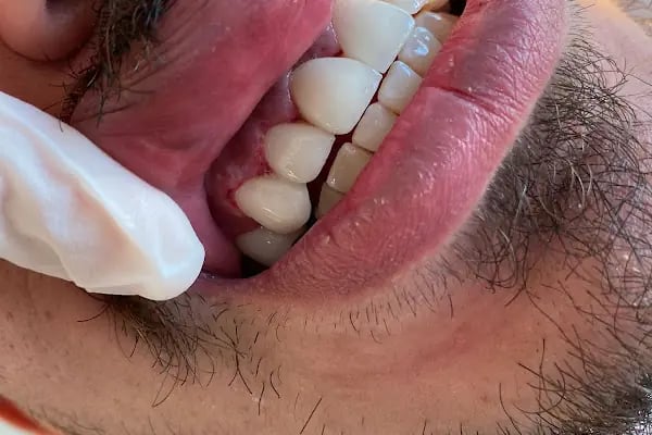 Özel Eftal Ağız ve Diş Sağlığı Polikliniği - Resim 15