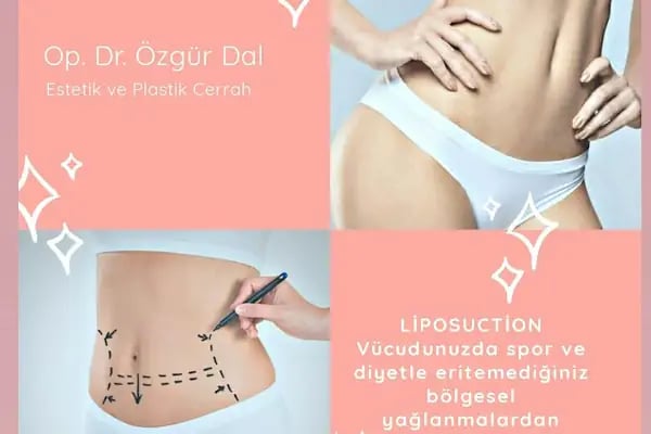 Op. Dr. Özgür Dal - Denizli Estetik ve Plastik Cerrahi Uzmanı - Resim 8