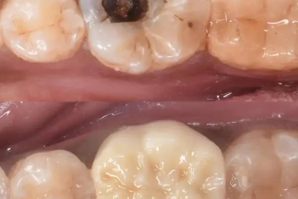 Özel Empladent Ağız Ve Diş Sağlığı Polikliniği - Resim 3