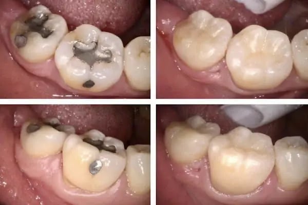 Özel Empladent Ağız Ve Diş Sağlığı Polikliniği - Resim 6