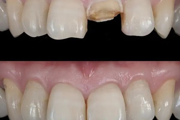 Özel Empladent Ağız Ve Diş Sağlığı Polikliniği - Resim 4