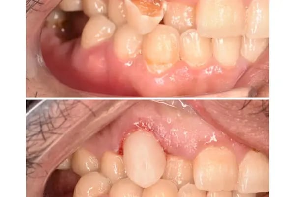 Özel Empladent Ağız Ve Diş Sağlığı Polikliniği - Resim 5