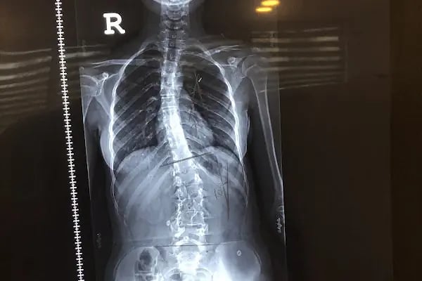 Prof. Dr. Akın Uğraş Ortopedi, Travmatoloji, Omurga Cerrahisi - Resim 8