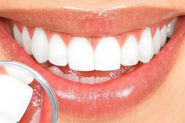 Fildent Ağız ve Diş Sağlığı Polikliniği - Resim 5