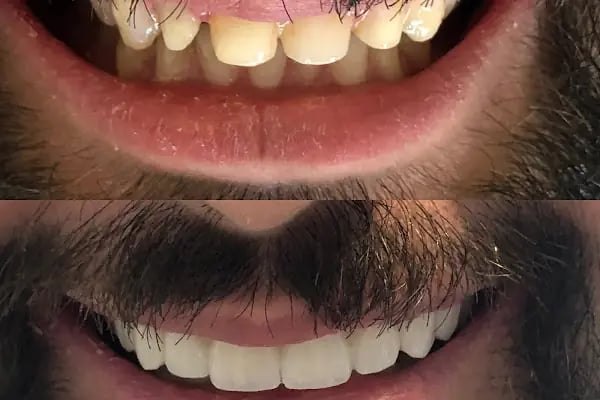 Özel Bursa Uzmanlar Ağız ve Diş Sağlığı - Resim 1