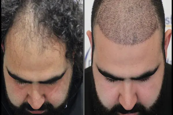 Esste Moda Hair - Resim 20