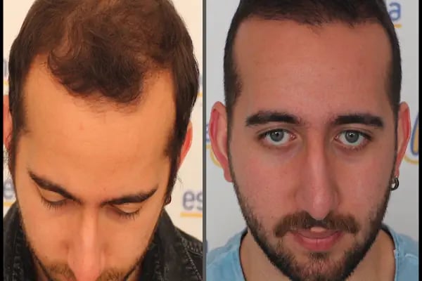 Esste Moda Hair - Resim 17