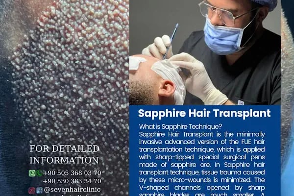 Seven Hair Clinic - Resim 8