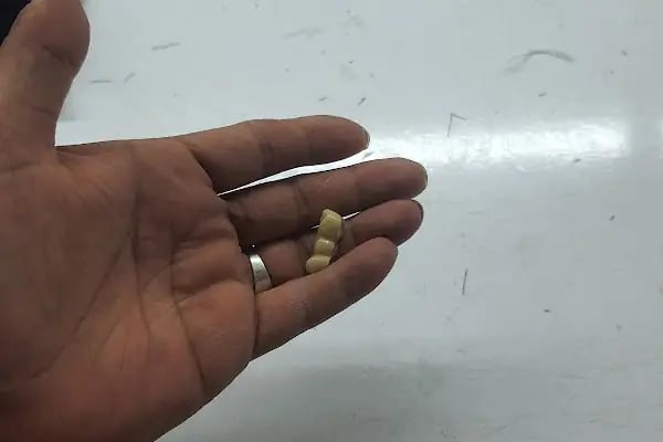Lotus Ağız ve Diş Sağlığı Polikliniği - Resim 15