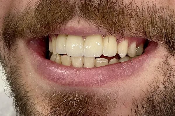Lotus Ağız ve Diş Sağlığı Polikliniği - Resim 8