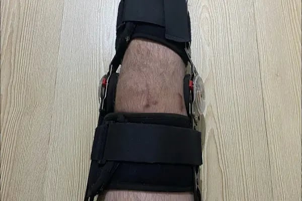 Op. Dr. Mehmet Baran Uslu - Ortopedi ve Travmatoloji - Ankara - Resim 20