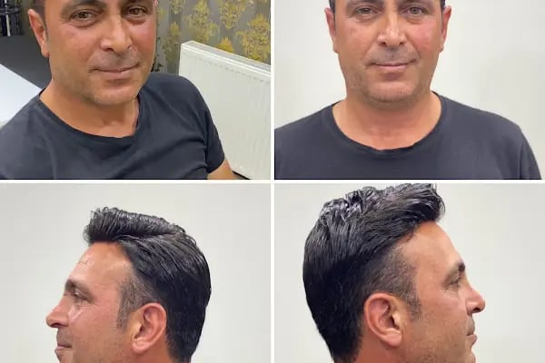 Bulut Protez Saç Merkezi - Resim 1