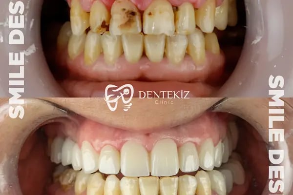 Dentekiz Clinic - Resim 17