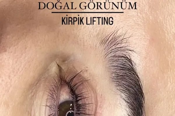 Aris Ezgi Doğan Balıkesir Güzellik Merkezi | Balıkesir Lazer Epilasyon | Balıkesir Cilt Bakımı - Resim 16