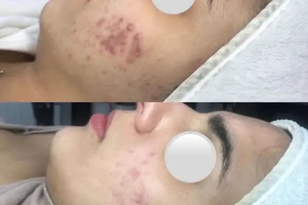 Aris Ezgi Doğan Balıkesir Güzellik Merkezi | Balıkesir Lazer Epilasyon | Balıkesir Cilt Bakımı - Resim 15