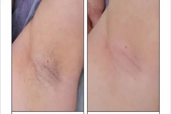 Aris Ezgi Doğan Balıkesir Güzellik Merkezi | Balıkesir Lazer Epilasyon | Balıkesir Cilt Bakımı - Resim 18