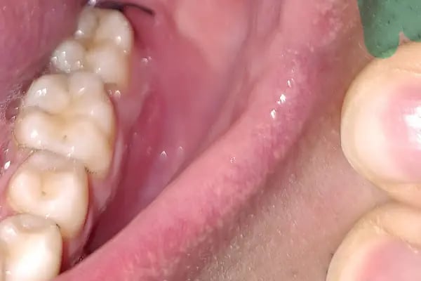 Özel SR Dental Ağız ve Diş Sağlığı Polikliniği - Resim 6