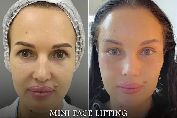 AESTHEAL CLİNİC - Resim 18