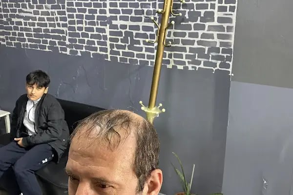 Arnavutköy Protez Saç Merkezi - Resim 11