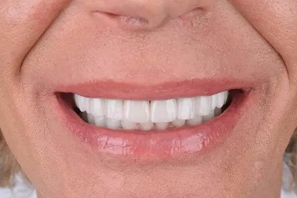 Dentgroup Antalya-Lara - Resim 20